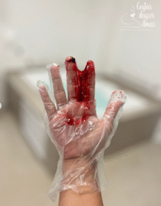 Sangue no Trabalho de Parto: Por que Ele Assusta (e Por que o Adoramos) sangue no parto